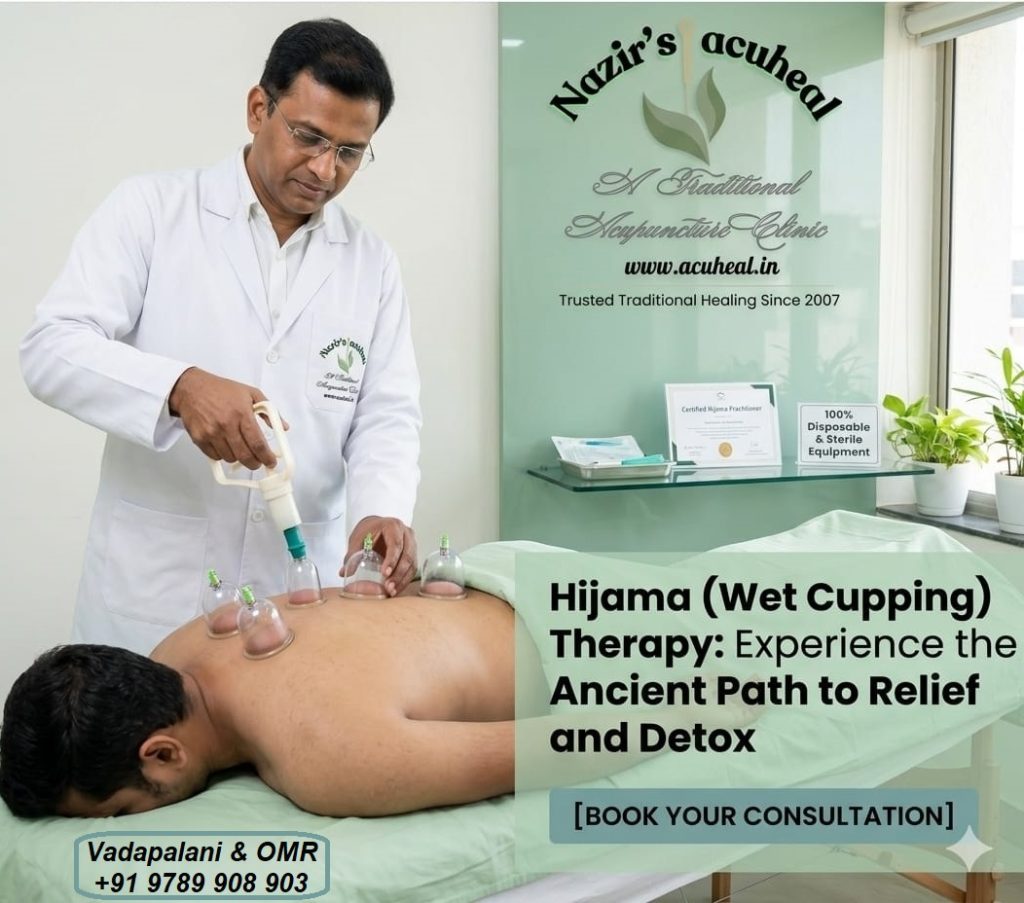 Best Hijama Cupping Therapy in Chennai – Serving Adyar, Anna Nagar & OMR Areas